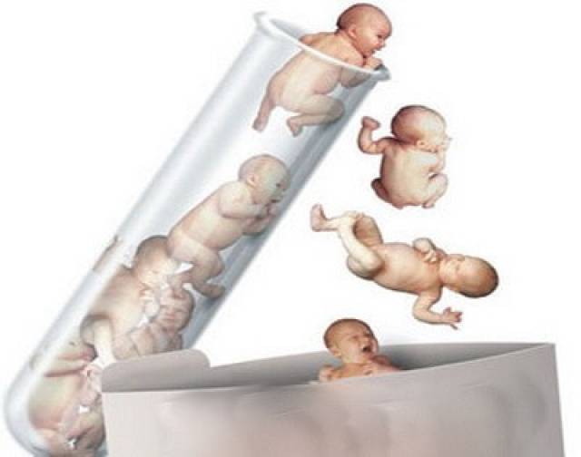 专家